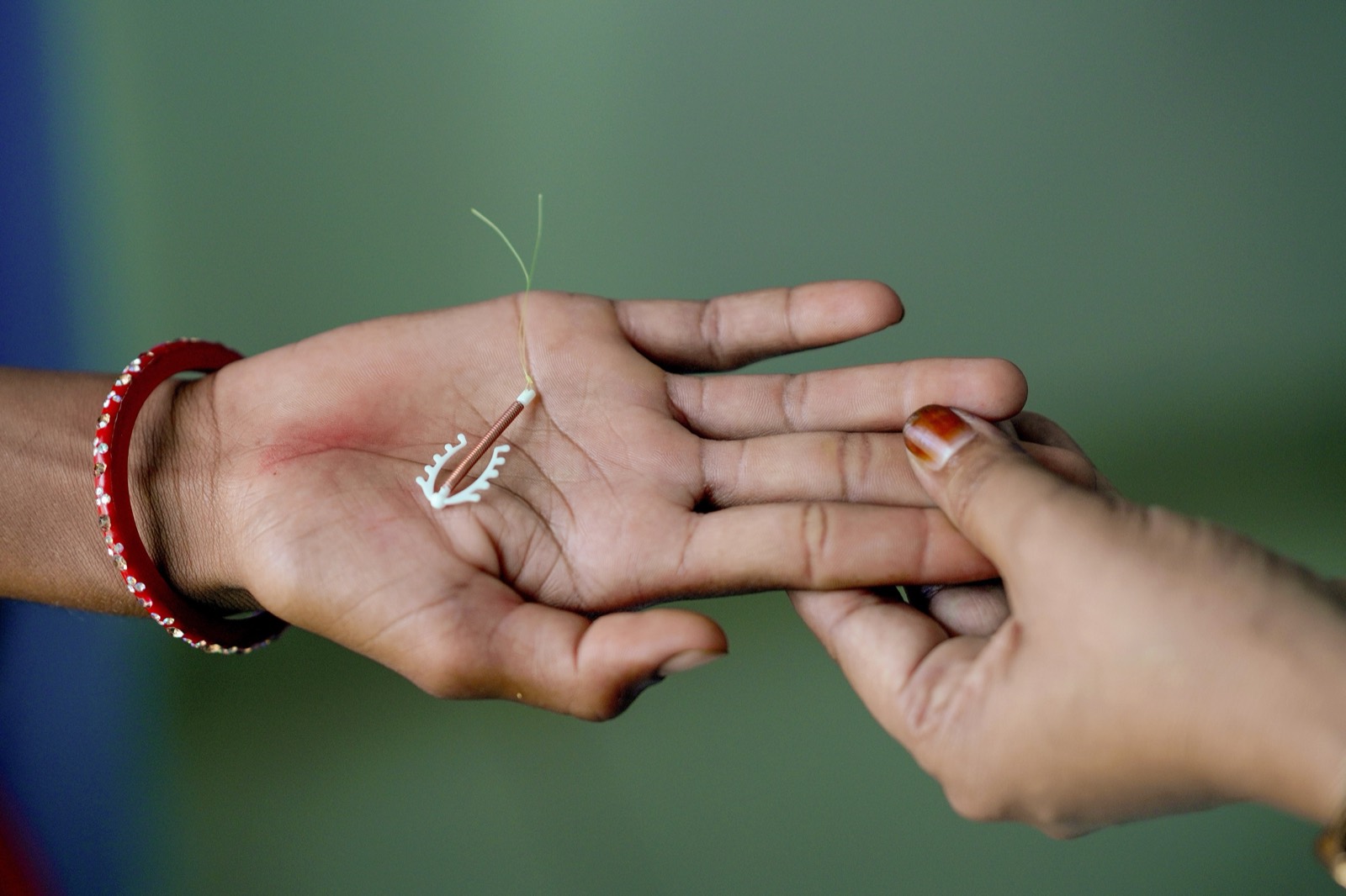 An intrauterine contraceptive device shown during a counselling session